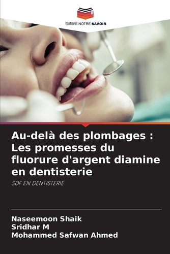 Au-delà des plombages