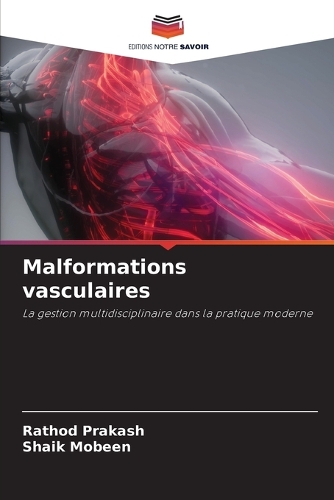 Malformations vasculaires