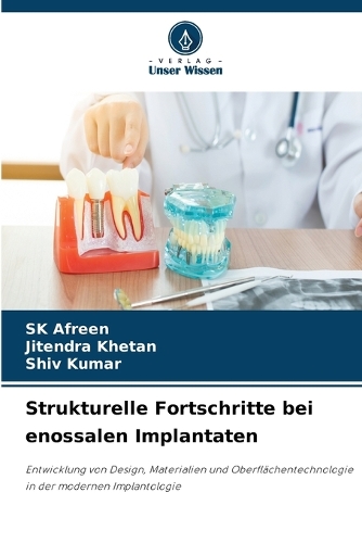 Strukturelle Fortschritte bei enossalen Implantaten