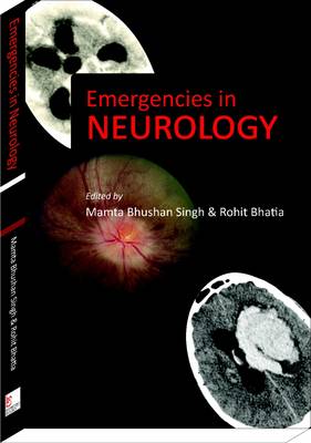 Emergencies in Neurology