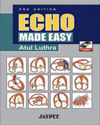 Echo Made Easy