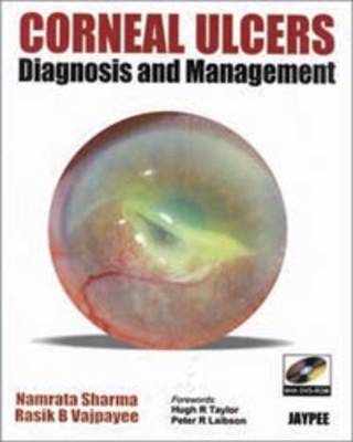 Corneal Ulcers Diagnosis and Management