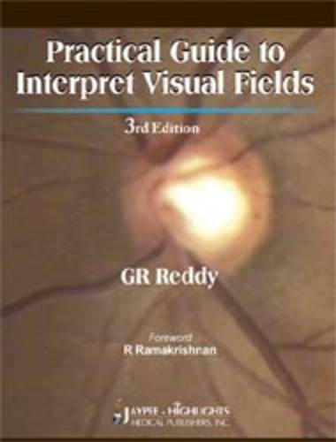Practical Guide to Interpret Visual Fields