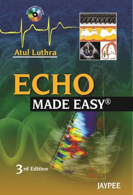 Echo Made Easy