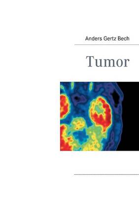 Tumor