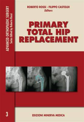 Primary Total Hip Replacement
