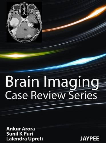 Brain Imaging