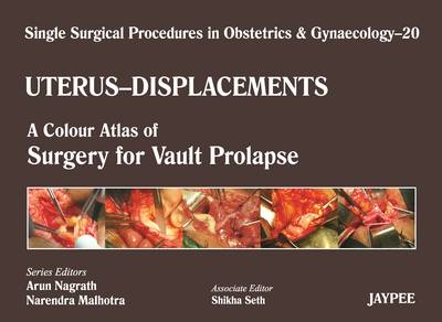 Single Surgical Procedures in Obstetrics and Gynaecology - Volume 20 - UTERUS - DISPLACEMENTS