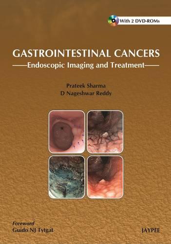 Gastrointestinal Cancers: