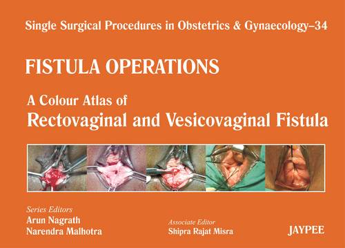 Single Surgical Procedures in Obstetrics and Gynaecology - 34 - Fistula Operations: A Colour Atlas of Rectovaginal and Vesicovaginal Fistula