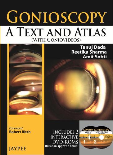 Gonioscopy: A Text and Atlas (with Goniovideos)