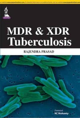 MDR and XDR Tuberculosis
