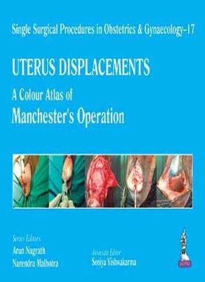 Single Surgical Procedures in Obstetrics and Gynaecology – 17 - UTERUS DISPLACEMENTS
