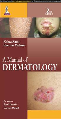 A Manual of Dermatology