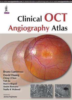 Clinical OCT Angiography Atlas