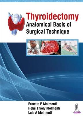 Thyroidectomy
