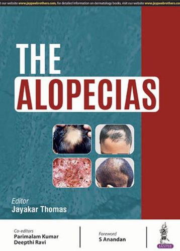 The Alopecias