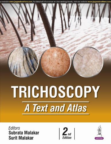 Trichoscopy
