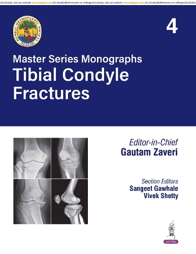 Master Series Monographs: Tibial Condyle Fractures