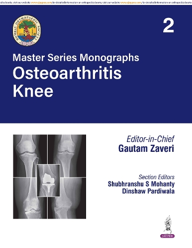 Master Series Monographs: Osteoarthritis Knee