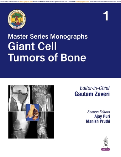 Master Series Monographs: Giant Cell Tumors of Bone
