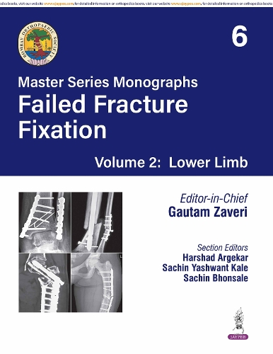 Master Series Monographs: Failed Fracture Fixation Volume 2: Lower Limb