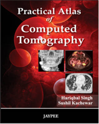 Practical Atlas of Computed Tomography