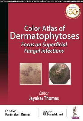 Color Atlas of Dermatophytoses