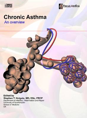 Chronic Asthma