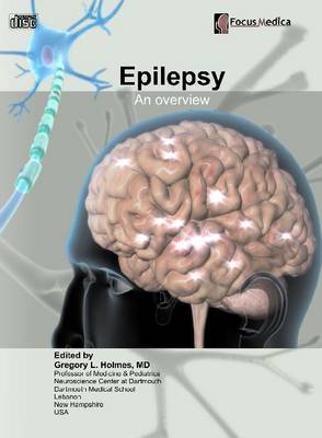 Epilepsy