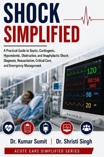 Shock Simplified
