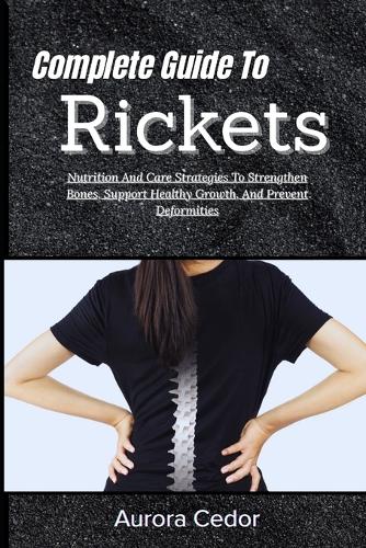 Complete Guide To Rickets