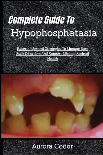 Complete Guide To Hypophosphatasia