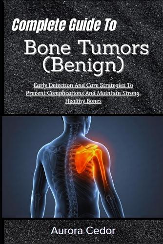 Complete Guide To Bone Tumors (Benign)