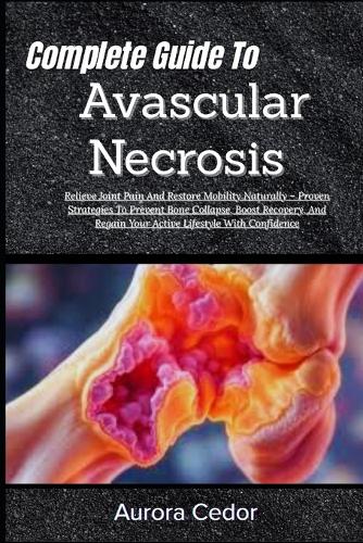 Complete Guide To Avascular Necrosis