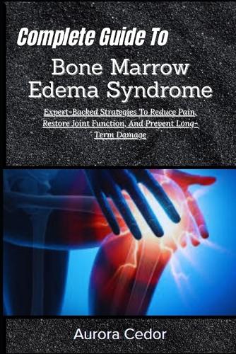 Complete Guide To Bone Marrow Edema Syndrome