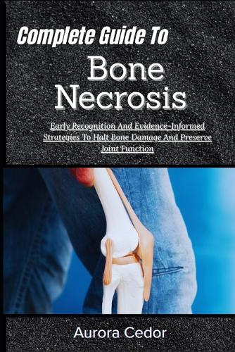 Complete Guide To Bone Necrosis