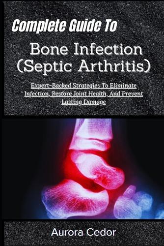 Complete Guide To Bone Infection (Septic Arthritis)