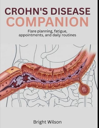 Crohn's Disease Companion