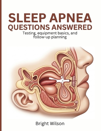 Sleep Apnea Questions Answered