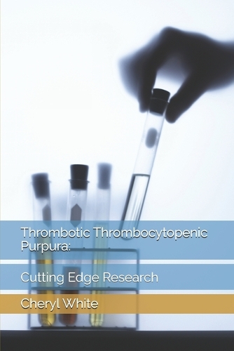 Thrombotic Thrombocytopenic Purpura