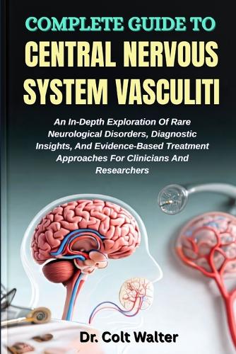 Complete Guide to Central Nervous System Vasculiti