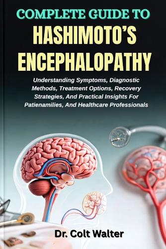 Complete Guide to Hashimoto's Encephalopathy