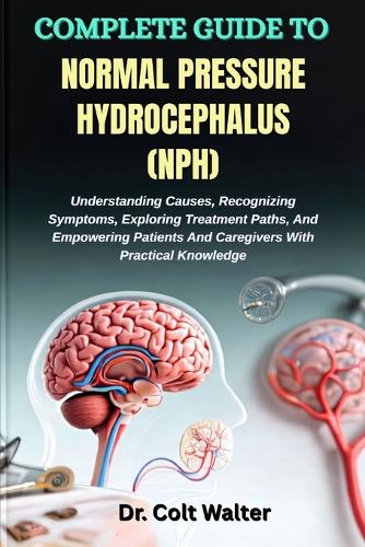 Complete Guide to Normal Pressure Hydrocephalus (Nph)