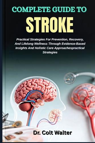 Complete Guide to Stroke