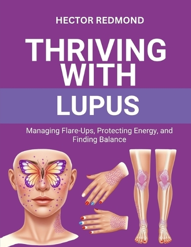 Thriving with Lupus