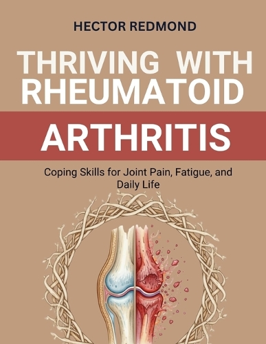 Thriving with Rheumatoid Arthritis