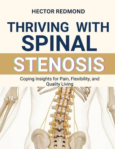 Thriving with Spinal Stenosis