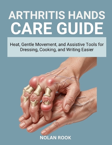 Arthritis Hands Care Guide