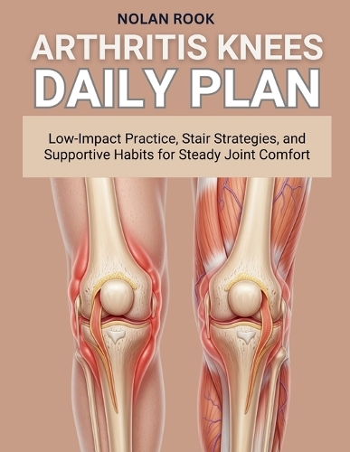 Arthritis Knees Daily Plan